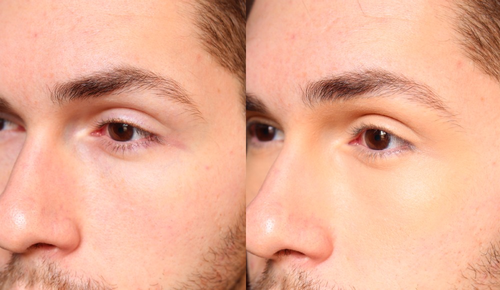 bb cream olhos antes e depois loreal medio